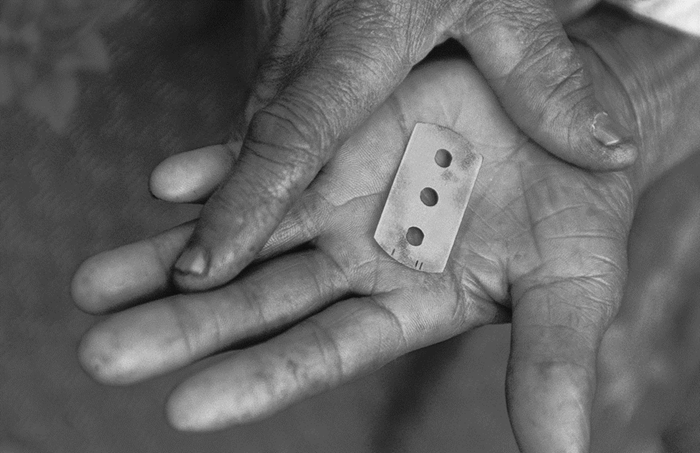 Das Foto zeigt eine Rasierklinge auf einer geöffneten Handfläche. (Quelle: Kindernothilfe) Das Foto zeigt eine Rasierklinge auf einer geöffneten Handfläche. (Quelle: Kindernothilfe)