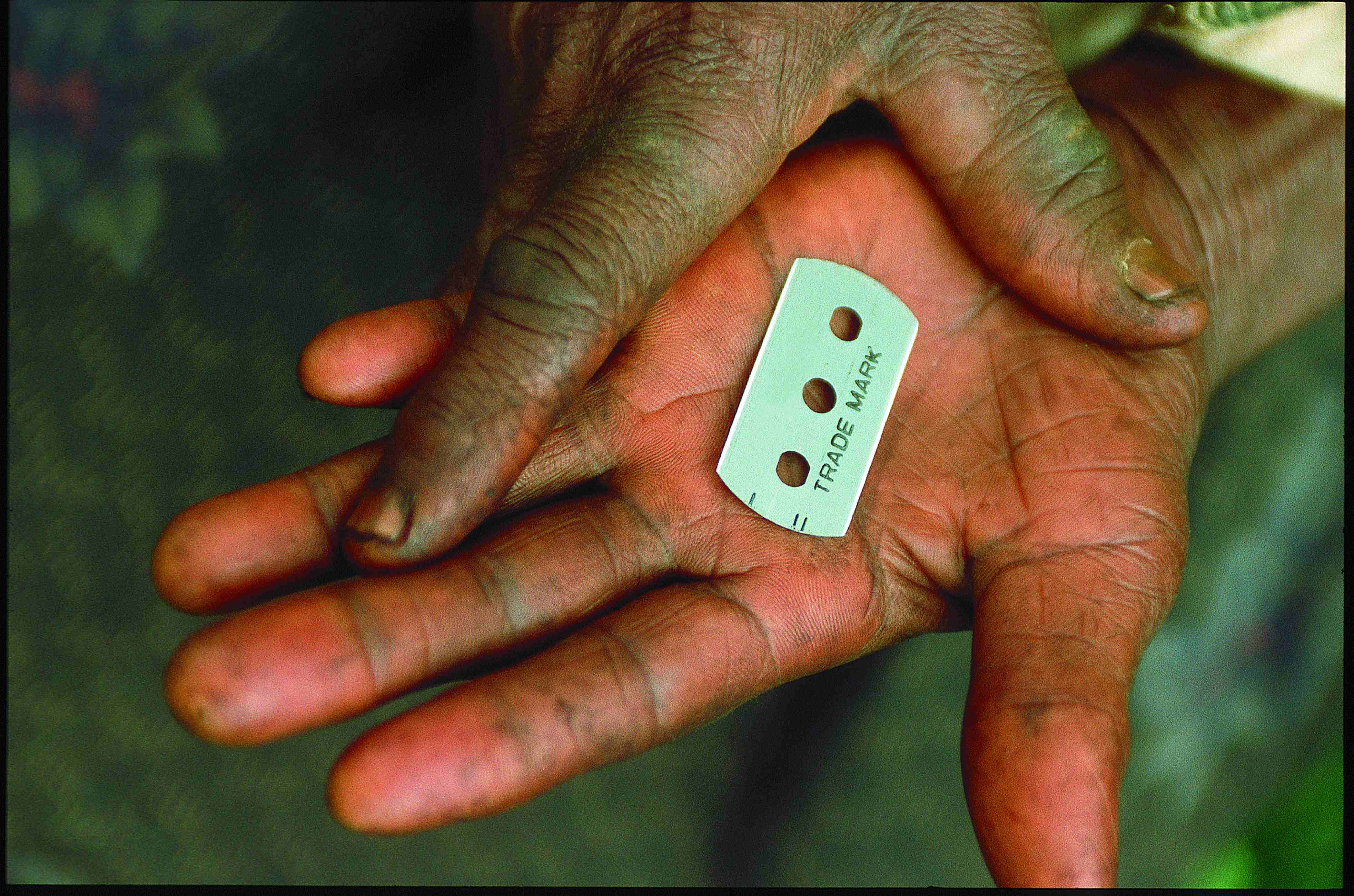 Eine Rasierklinge auf der Handfläche einer Frau. (Quelle: Christoph Engel)